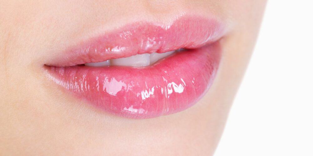 lippen opvullen, lip fillers, lipflip