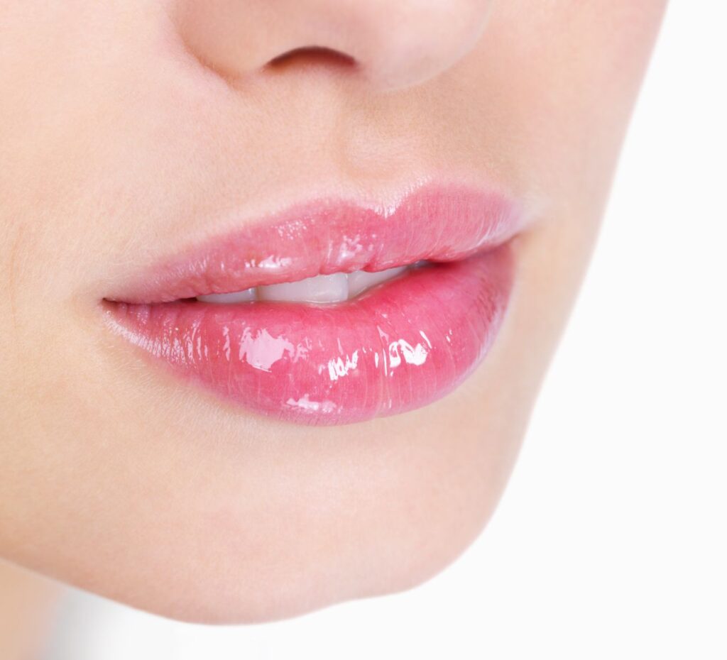 lippen opvullen, lip fillers, lipflip